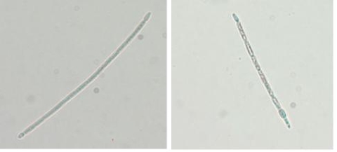 Cylindrospermopsis sp. 광학현미경 사진