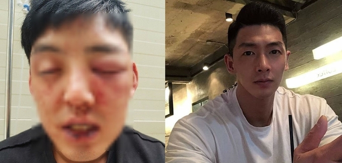 왼쪽 - 차오름이 폭행 당한 후 올린 사진. 오른쪽 - 양호석 SNS 캡처